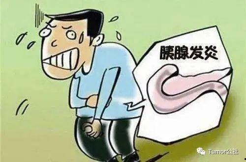 天津胰腺炎网红去世,追忆生命之光与网络热度背后的故事