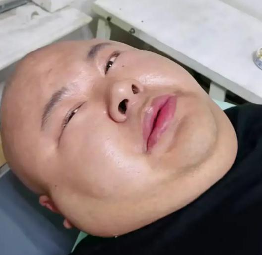 网红狗老师的什么病了,揭秘其罕见病症之谜