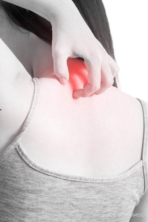 明星患湿疹经历,揭秘明星护肤背后的湿疹挑战